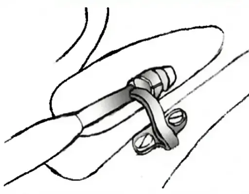 [DVI_AC_MONTURE_PLAQ] DVI - Clip monture 062